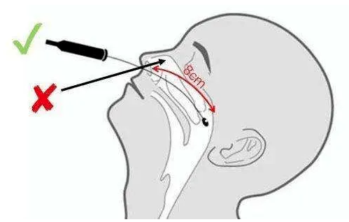 戳舌头、刮牙齿、捅喉咙，哪种才是正确的核酸采样方法？ 第9张插图
